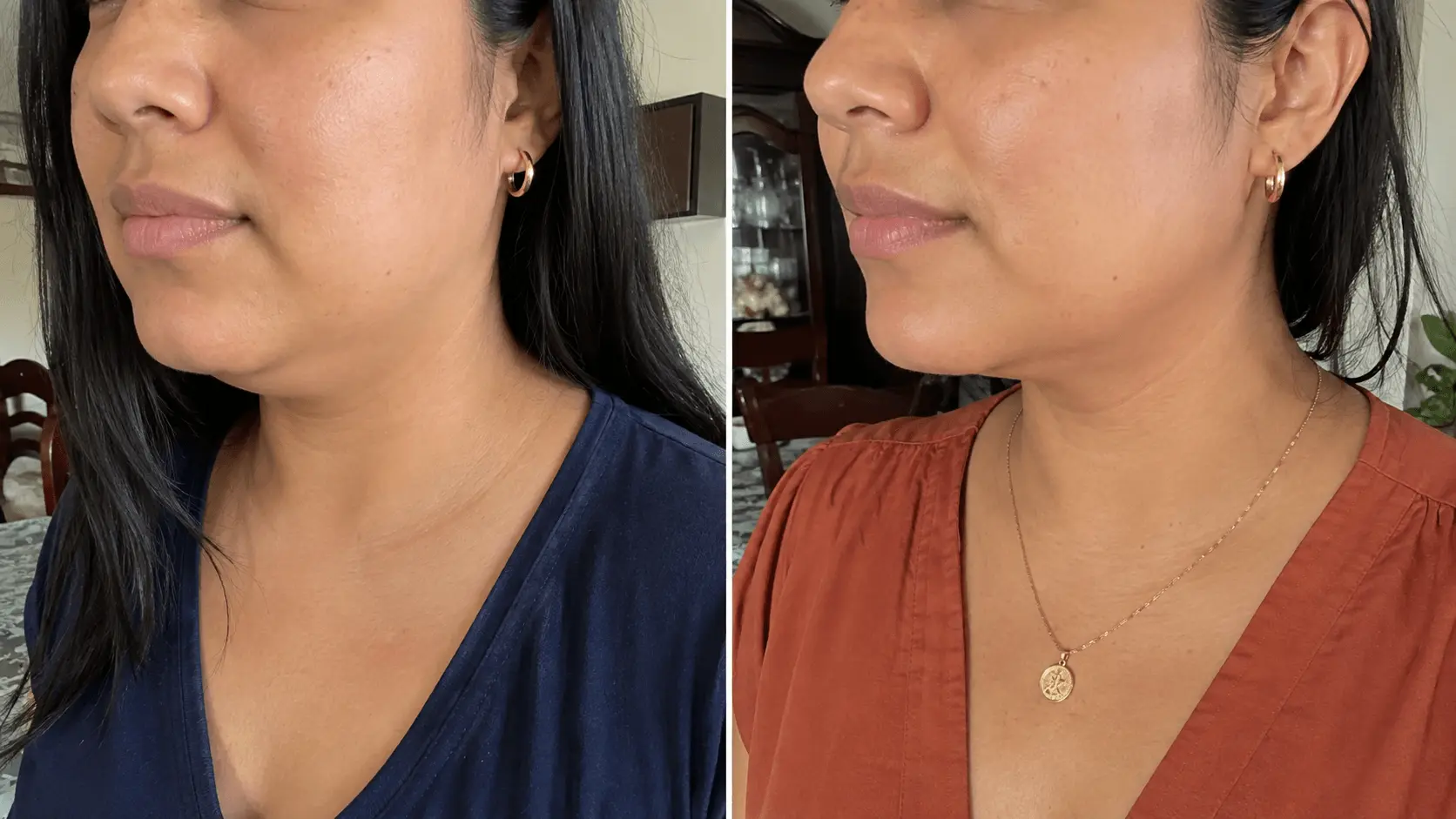 Antes y después del ritual facial — Valeria Morales