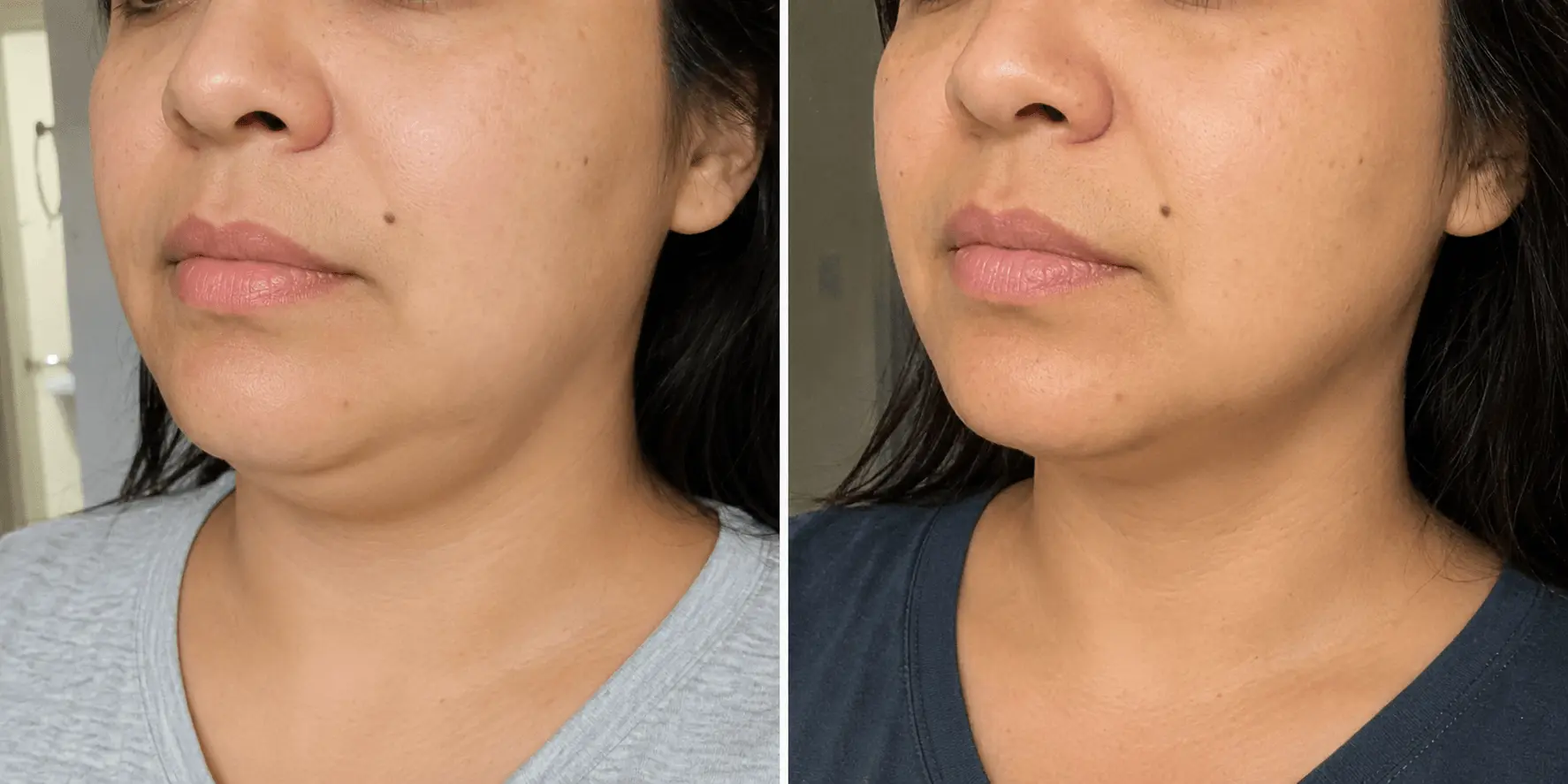 Antes y después del ritual facial — Sofía Ramírez