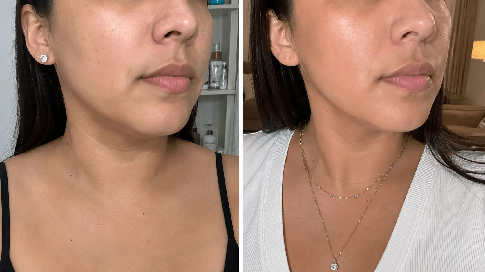 Antes y después del ritual facial — Camila Hernández