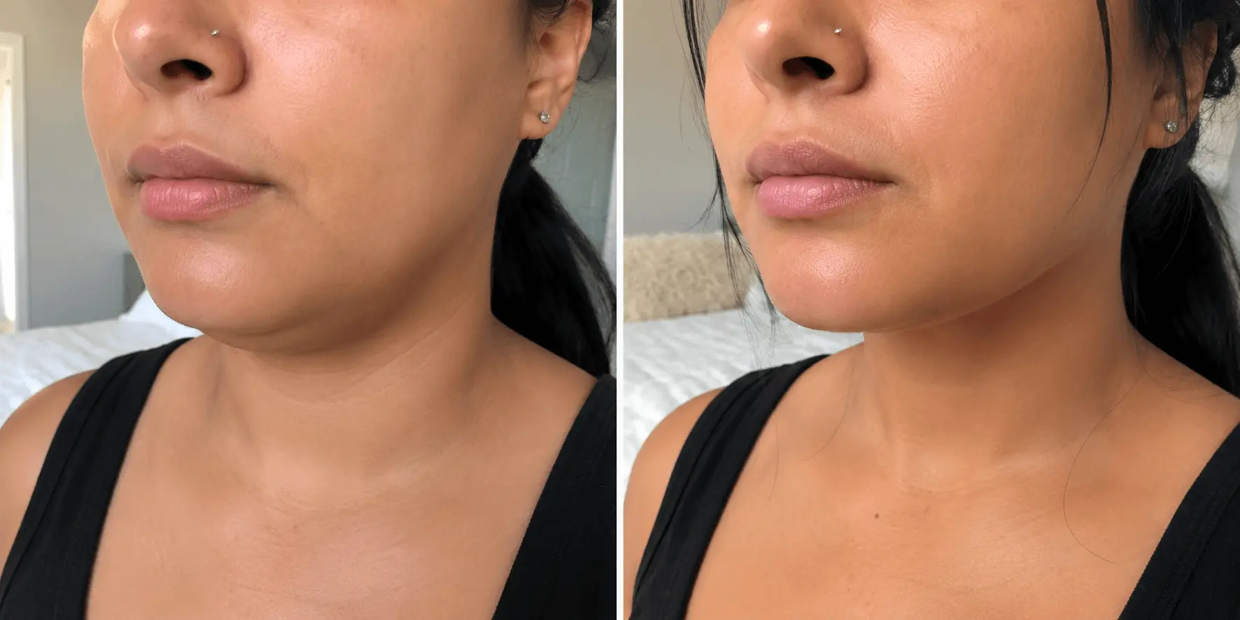 Antes y después del ritual facial — Daniela Torres